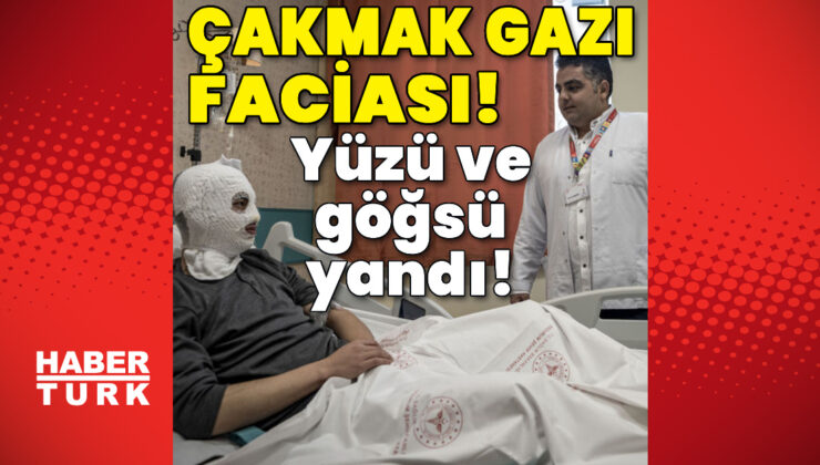 Erzurum’da Çakmak Gazı Faciası: Yüzü ve Göğsü Yanan Gencin Tedavisi Sürüyor