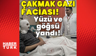 Erzurum’da Çakmak Gazı Faciası: Yüzü ve Göğsü Yanan Genç Hastanede Tedavi Altında