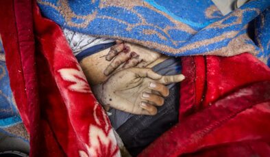 Gazze’deki Can Kayıpları: Yeni Araştırma, Rapor Edilenden Çok Daha Yüksek Ölü Sayılarına İşaret Ediyor