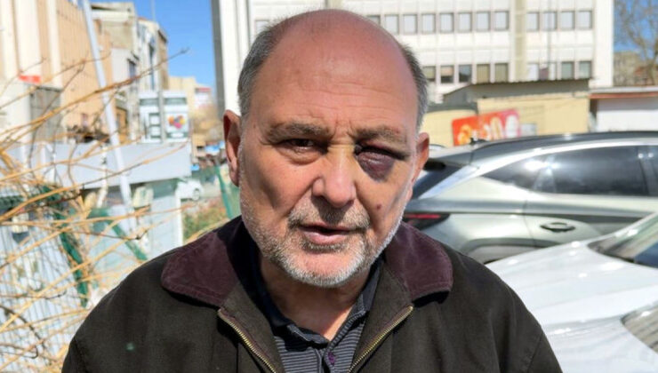 Annesinin Cenazesinden Dönen Adam Sokakta Saldırıya Uğradı: ‘Çift Görüyorum, Şikayetçiyim’