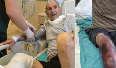 Lavabo Açıcı Faciası: Ağrı’da Yaşlı Adam Kimyasal Yanıkla Hastanelik Oldu