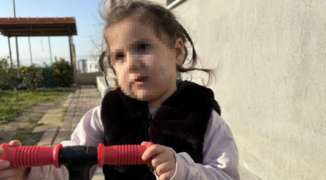 İzmir’de Köpek Saldırısı: 3 Yaşındaki Ada, Komşu Köpeklerin Saldırısına Uğradı