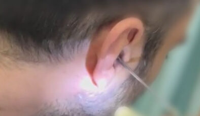 Kayseri’de Polisten Uyuşturucu Operasyonu: Kulaktan 0.25 Gram Uyuşturucu Çıktı