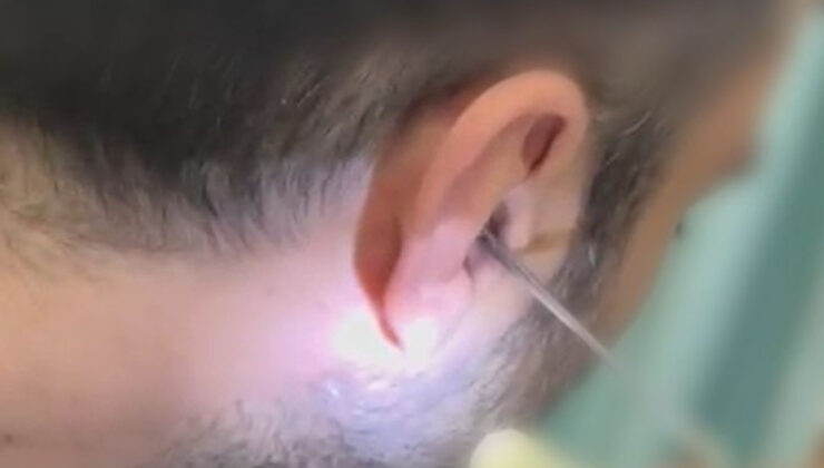 Kayseri’de Polisten Uyuşturucu Operasyonu: Kulaktan 0.25 Gram Uyuşturucu Çıktı