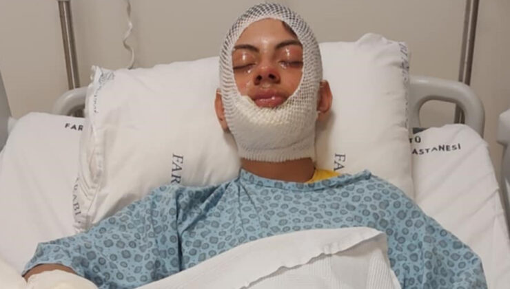 Trabzon’da Isınmak İçin Ateşe Benzin Döken Genç Yanarak Yaralandı: Sağlık Durumu İyi