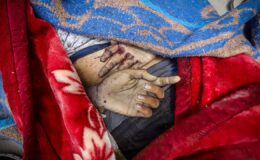 Gazze’deki Can Kaybı Artıyor: İsrail Saldırıları 72 Bini Aştı