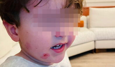 Bursa’da Kreşte Şiddet İddiası: 2 Yaşındaki Çocuk Darp Edildi, Soruşturma Başlatıldı