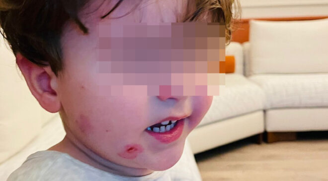 Bursa’da Kreşte Şiddet İddiası: 2 Yaşındaki Çocuk Darp Edildi, Soruşturma Başlatıldı