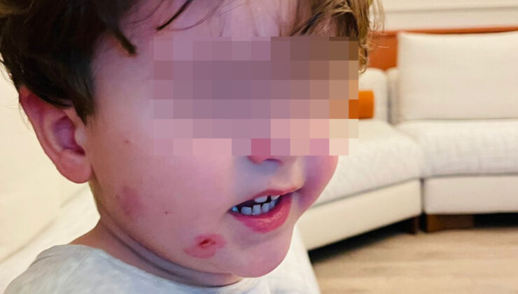 Bursa’da Kreşte Şiddet İddiası: 2 Yaşındaki Çocuk Darp Edildi, Soruşturma Başlatıldı