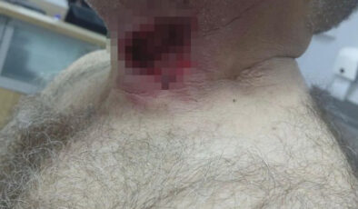 Diyarbakır’da Korkunç Olay: Attan Düşen Adam, Boğazından Isırılarak Ağır Yaralandı