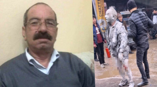 Diyarbakır’daki Soba Patlamasında Ağır Yaralanan Vatandaş Hayatını Kaybetti