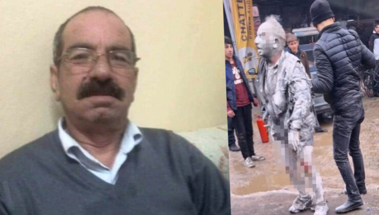 Diyarbakır’daki Soba Patlamasında Ağır Yaralanan Vatandaş Hayatını Kaybetti