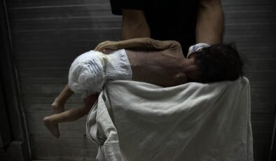 Gazze’de Savaşın Gölgesinde Bebek Ölümleri ve Doğum Kusurları Artıyor: Yetersiz Beslenme ve Sağlık Hizmetlerinin Çöküşü Facia Yaratıyor