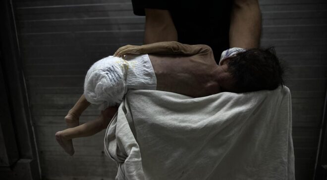 Gazze’de Savaşın Gölgesinde Bebek Ölümleri ve Doğum Kusurları Artıyor: Yetersiz Beslenme ve Sağlık Hizmetlerinin Çöküşü Facia Yaratıyor