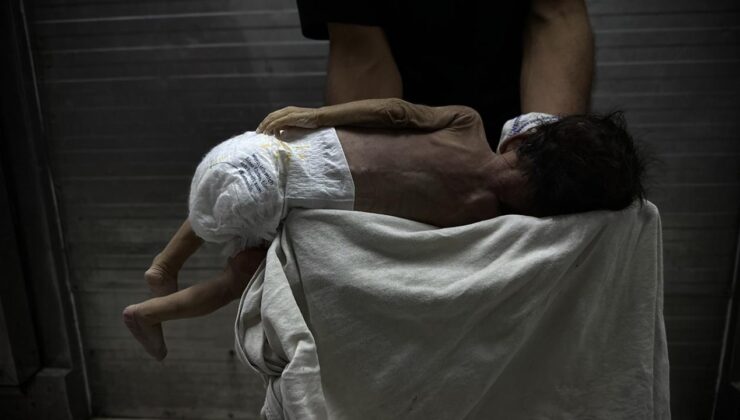 Gazze’de Savaşın Gölgesinde Bebek Ölümleri ve Doğum Kusurları Artıyor: Yetersiz Beslenme ve Sağlık Hizmetlerinin Çöküşü Facia Yaratıyor