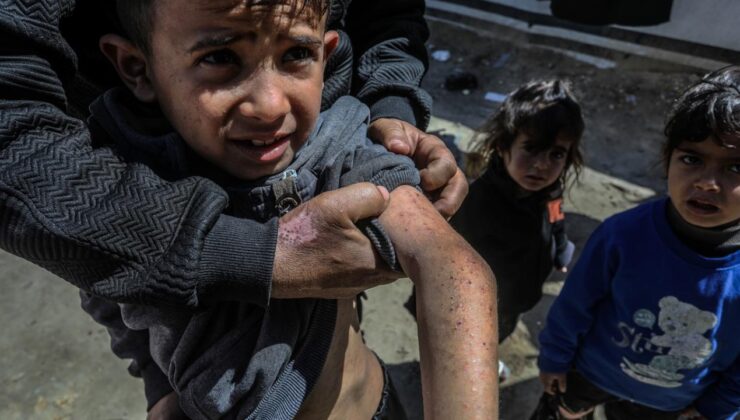 Gazze’de Sağlık Krizi: Filistin Sağlık Bakanlığı’ndan Salgın Hastalık Uyarısı