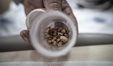 İstanbul’dan Erzurum’a Şifa Yolculuğu: 2 Çocuk Annesinden 51 Taş Çıktı!