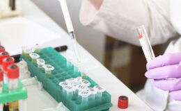 Akdeniz’de Araştırma ve İnovasyona Destek: TÜBİTAK’tan PRIMA Çağrısı Başladı