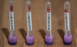 CDC, Hantavirüs Vakaları Nedeniyle Acil Durum Operasyon Merkezini Harekete Geçirdi: Halk Sağlığı İzlemede
