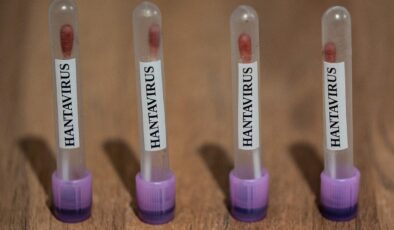 CDC, Hantavirüs Vakaları Nedeniyle Acil Durum Operasyon Merkezini Harekete Geçirdi: Halk Sağlığı İzlemede
