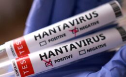 Hantavirüs Salgını: Yolcu Gemisinde 5 Vaka Doğrulandı, Tahliyeler Devam Ediyor
